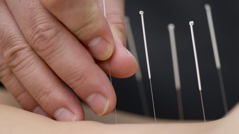 Acupuncture found to help treat men with erectile dysfunction and fertility issues